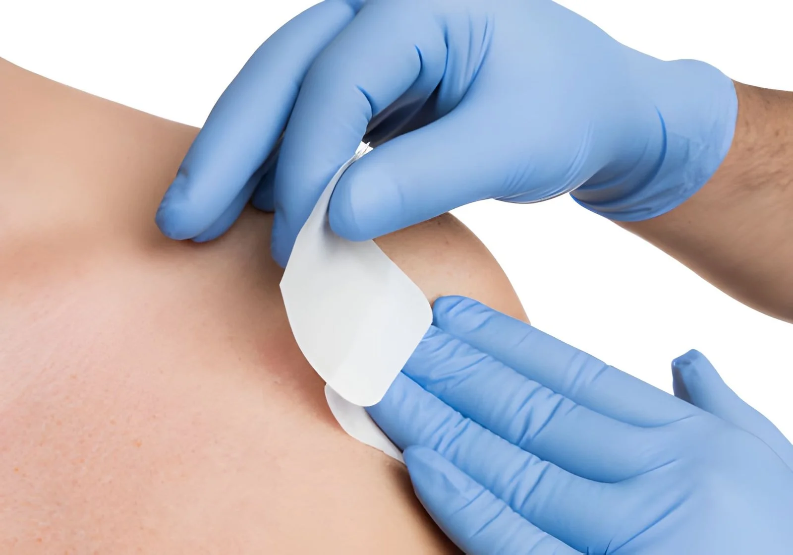 Wound Biopsy